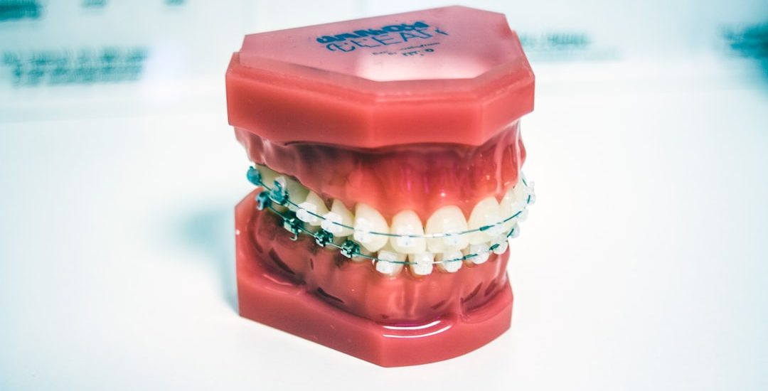 Photo Dental braces